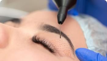 Conheça o nosso procedimento Eletrocaltério