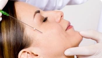 Conheça o nosso procedimento Fios de PDO