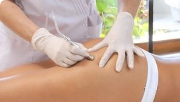 Conheça o nosso procedimento Microdermoabrasão